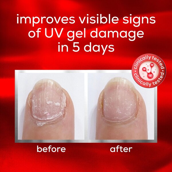 essie Nail Care, To the Rescue Nail Repair