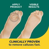 Dr. Scholl's Duragel Callus Remover, thumbnail image 3 of 6