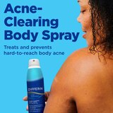 Differin Acne-Clearing Body Spray, thumbnail image 3 of 6