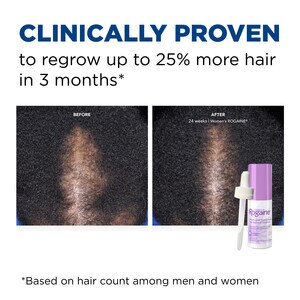 Rogaine Womens Minoxidil Hair Thinning Loss Treatment Topical