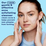Clean & Clear Acne Triple Clear Exfoliating Scrub, 5 OZ, thumbnail image 4 of 13