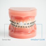OrthoDots CLEAR, Pain and Irritation Relief from Orthodontic Appliances, 12CT, thumbnail image 5 of 5