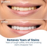 CVS Health Professional White Teeth Whitening Strips, thumbnail image 3 of 9