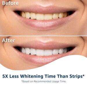 Cvs health whitening pen mychart adventist health