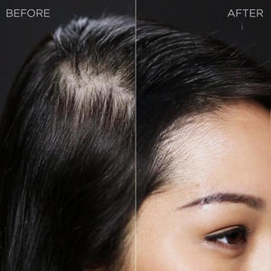 Toppik Hair Building Fibers Toppik Hair Building Fibers