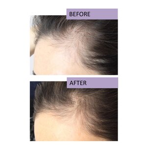 RapidHair Hair Volumizing Formula,  OZ - CVS Pharmacy