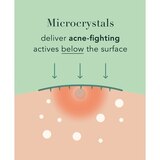 Rael Beauty Miracle Patch Microcrystal Spot Cover, thumbnail image 3 of 4