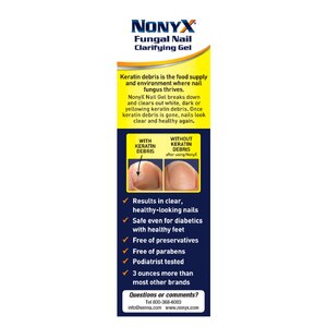 NONYX Fungal Nail Clarifying Gel, 4 OZ NONYX Fungal Nail Clarifying Gel, 4 OZ