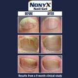 NONYX Fungal Nail Clarifying Gel, 4 OZ, thumbnail image 5 of 6