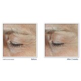 RoC Derm Correxion Dual Eye Cream, .68 oz, thumbnail image 4 of 8