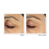RoC Retinol Correxion Anti-Aging Eye Cream Treatment, 0.5 OZ, thumbnail image 3 of 6