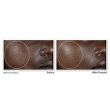 RoC Multi Correxion 5 in 1 Anti-Aging Facial Night Cream, 1.7 OZ, thumbnail image 4 of 8