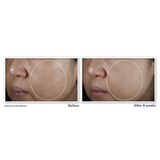 RoC Multi Correxion 5 in 1 Anti-Aging Facial Night Cream, 1.7 OZ, thumbnail image 5 of 8
