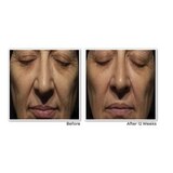 RoC Retinol Correxion Deep Wrinkle Anti-Aging Night Face Cream, 1 OZ, thumbnail image 3 of 6