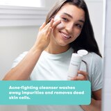 Proactiv Solution Renewing Cleanser, thumbnail image 4 of 5