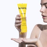 Acnemy Zitclean Purifying Cleansing Gel, thumbnail image 4 of 5
