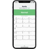 AliveCor KardiaMobile 6L Personal EKG Monitor, thumbnail image 3 of 5
