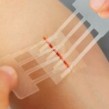 Clozex Laceration Kit with Accessories, 1.5", 1 CT, thumbnail image 5 of 5