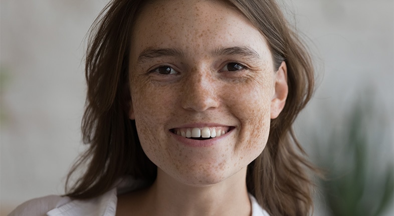Young woman with clear, freckled skin, smiling.