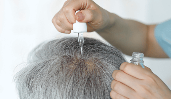 What Causes Hair Loss? | MinuteClinic
